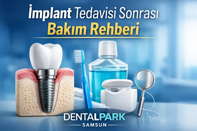 dentalpark samsun implant tedavisi sonrası bakım rehberi