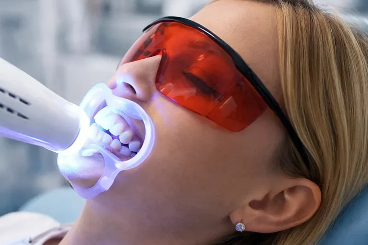 dentalpark samsun diş beyazlatma