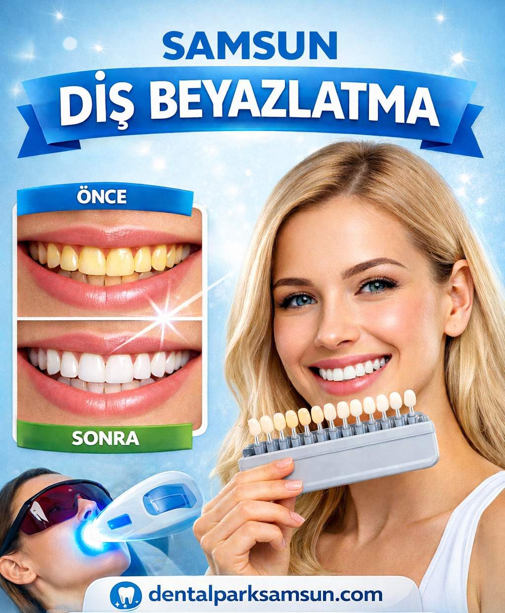Samsun diş beyazlatma işlemi hakkında bilgilendirme