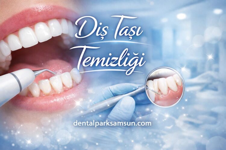 Samsun Diş Taşı Temizliği