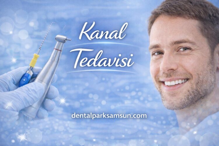 Samsun Kanal Tedavisi Süreç, Ağrı Ve Bakım Rehberi