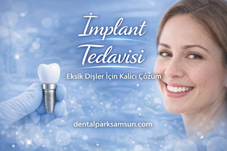 samsun implant