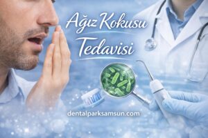 Samsun ağız kokusu tedavisi