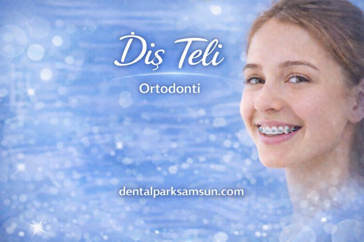 Samsun Diş teli tedavisi ortodonti ve diş plağı