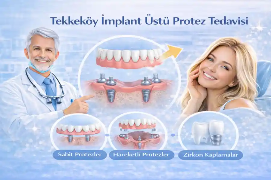 Samsun Tekkeköy implant tedavisi