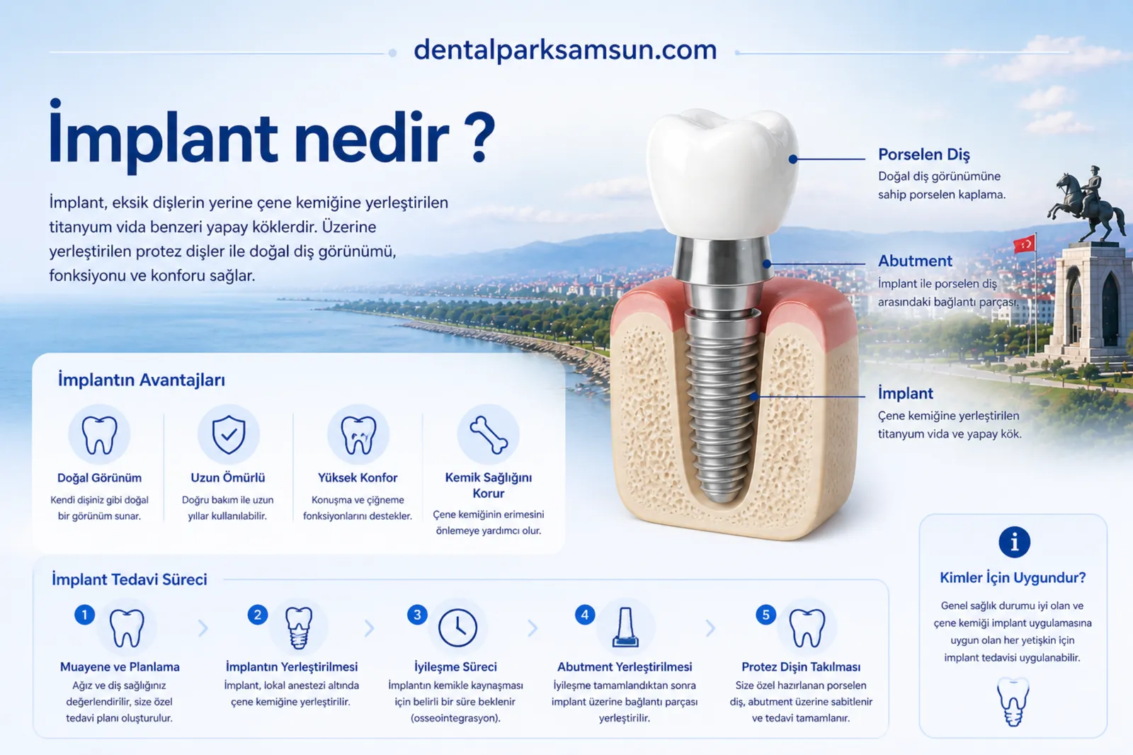 samsun implant nedir?