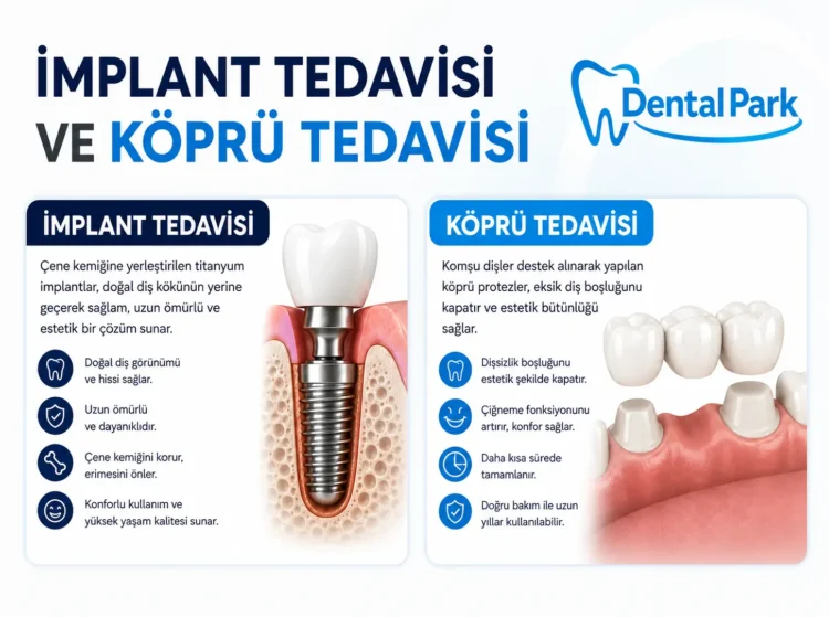samsun kavak implant tedavisi ve köprü tedavisi