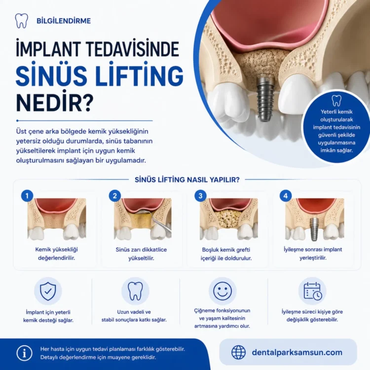 implant tedavisinde sinüs lifting