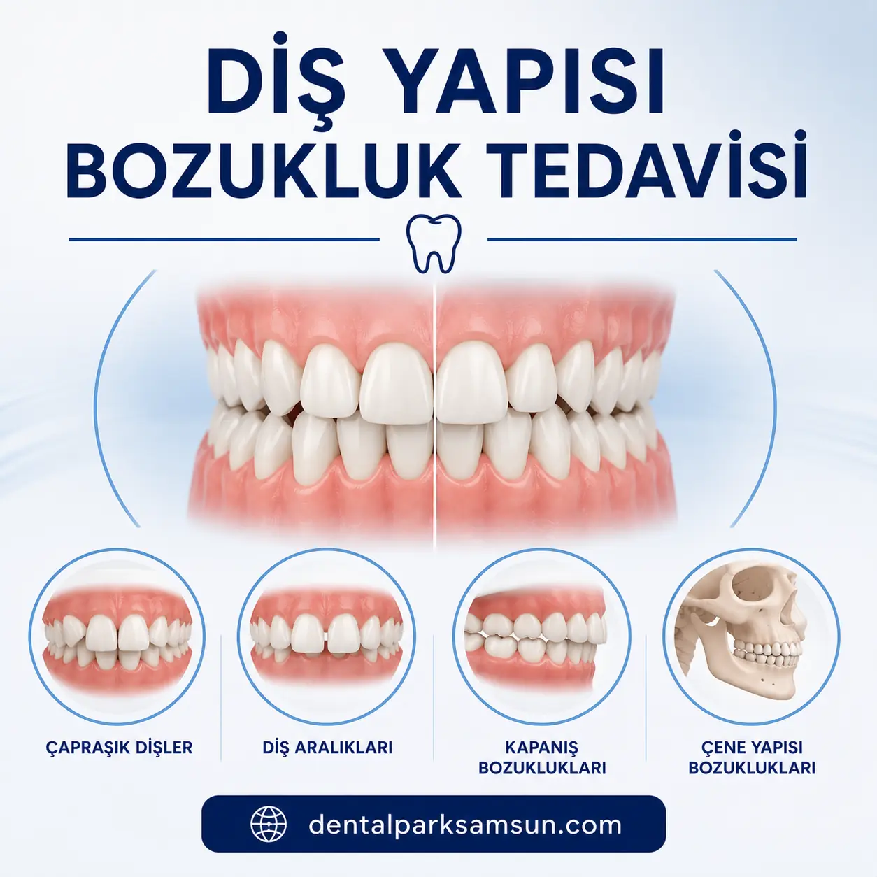 Diş yapısı bozukluk tedavisi