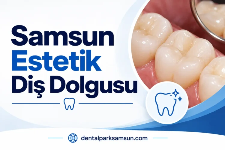 Samsun estetik diş dolgusu