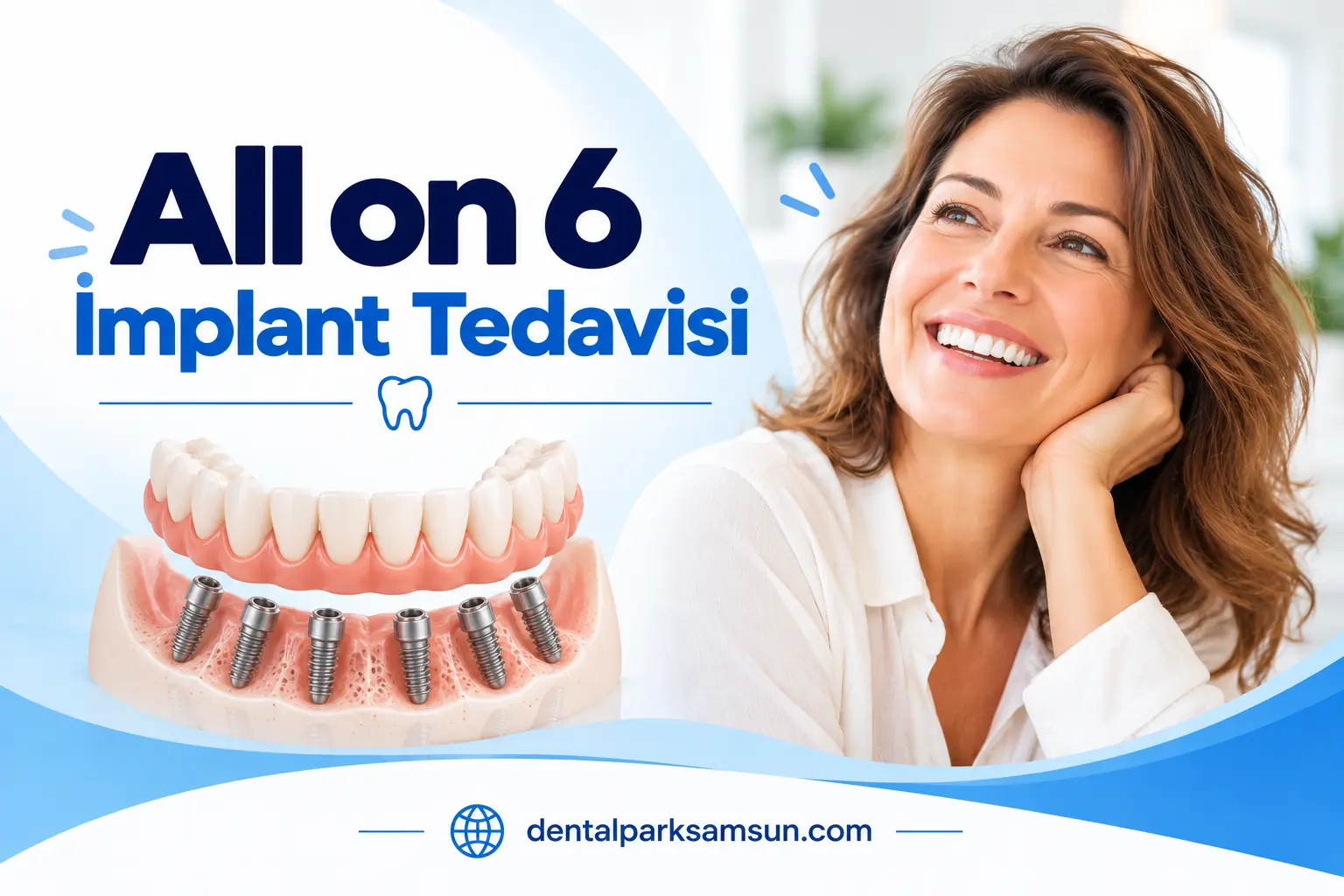 Samsun All-On-6 implant tedavisi