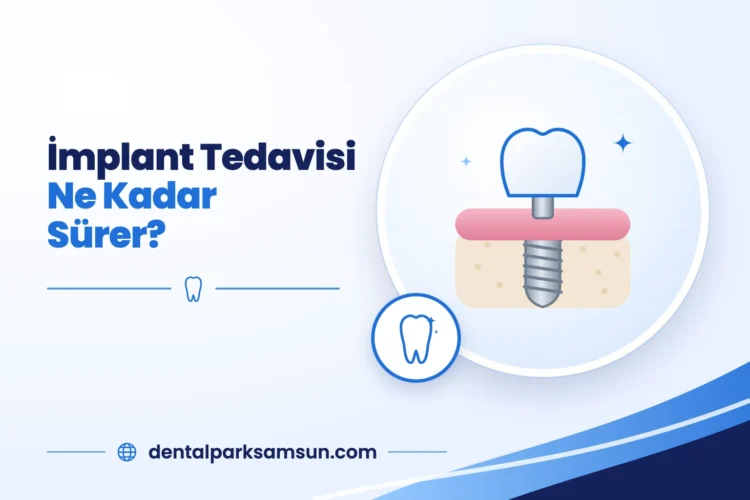Samsun'da implant tedavisi ne kadar sürer