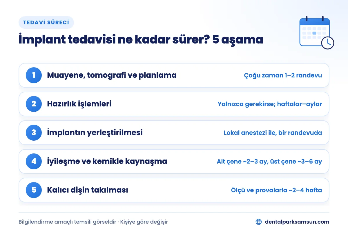 İmplant tedavisi ne kadar sürer sorusuna yanıt veren 5 aşama: muayeneden kalıcı dişe
