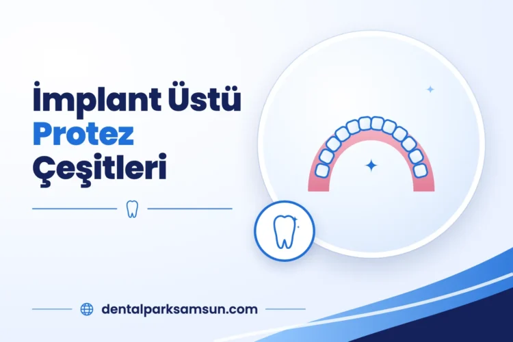 Samsun'da implant üstü protez çeşitleri