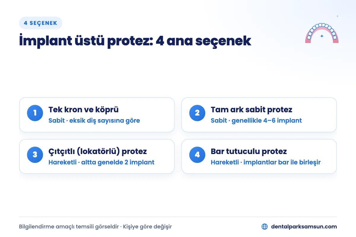 İmplant üstü protez çeşitleri: tek kron ve köprü, tam ark sabit, çıtçıtlı ve bar tutuculu protez
