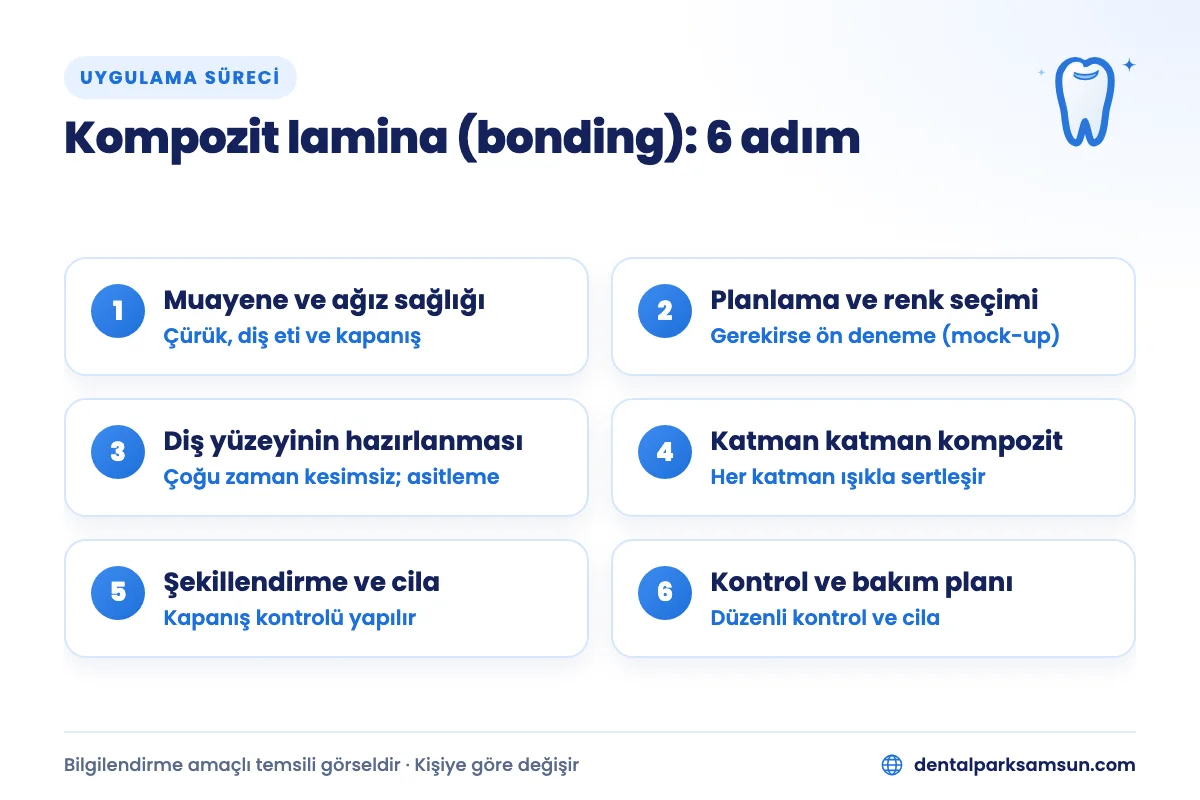 Samsun kompozit lamina süreci: muayeneden kontrol randevusuna 6 adım