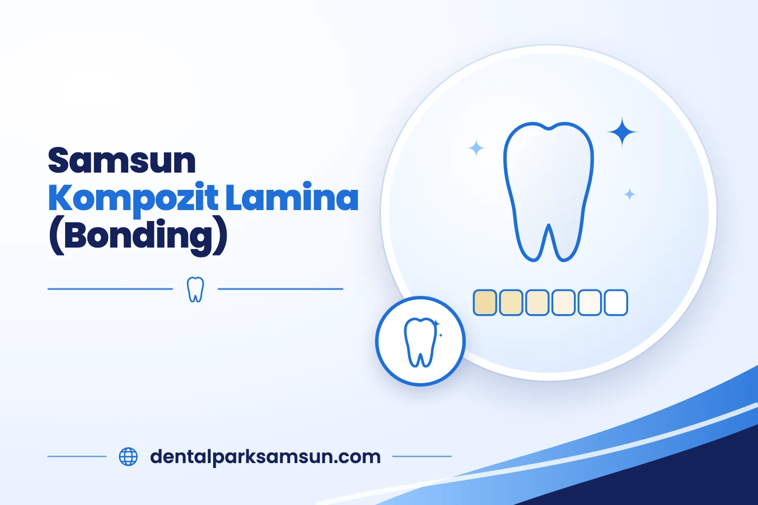Samsun kompozit lamina (bonding) uygulaması