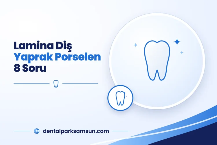 Samsun lamina diş ve yaprak porselen hakkında 8 soru