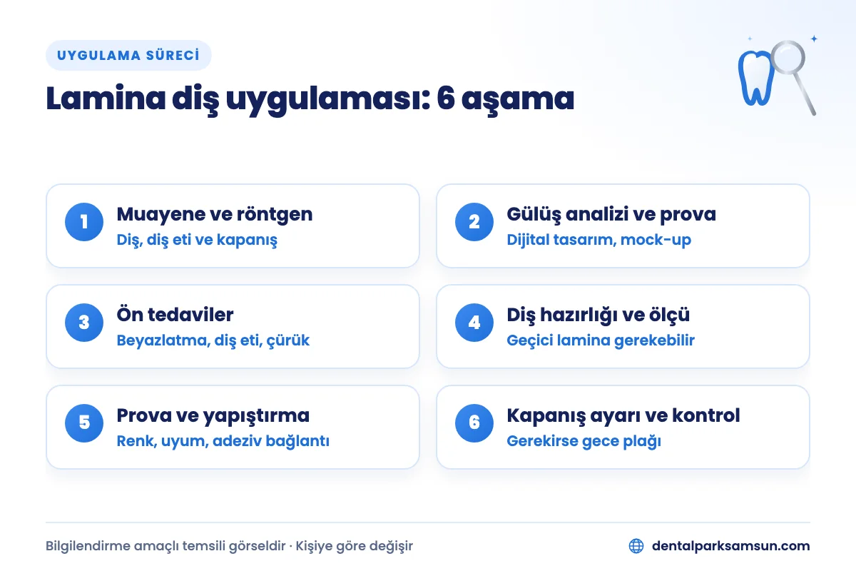 Samsun lamina diş uygulaması aşamaları: muayene, gülüş analizi, ön tedavi, diş hazırlığı, yapıştırma ve kontrol