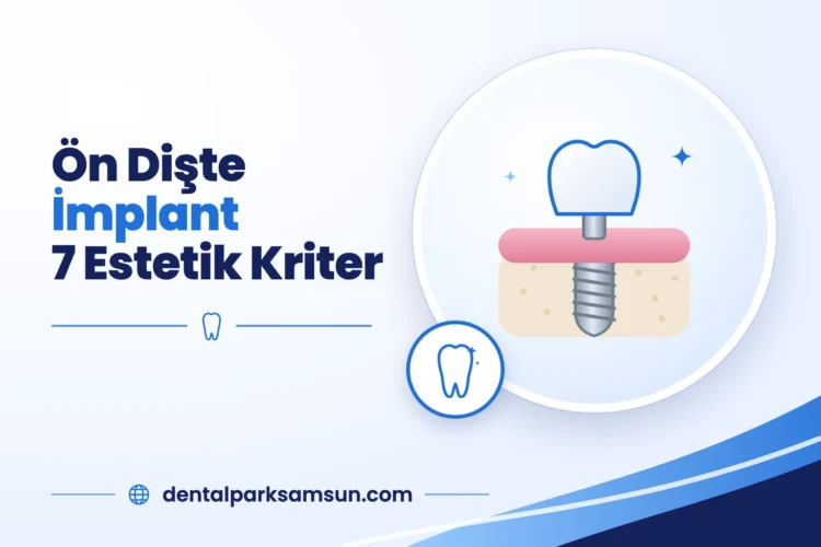 Samsun ön dişte implant için 7 estetik kriter