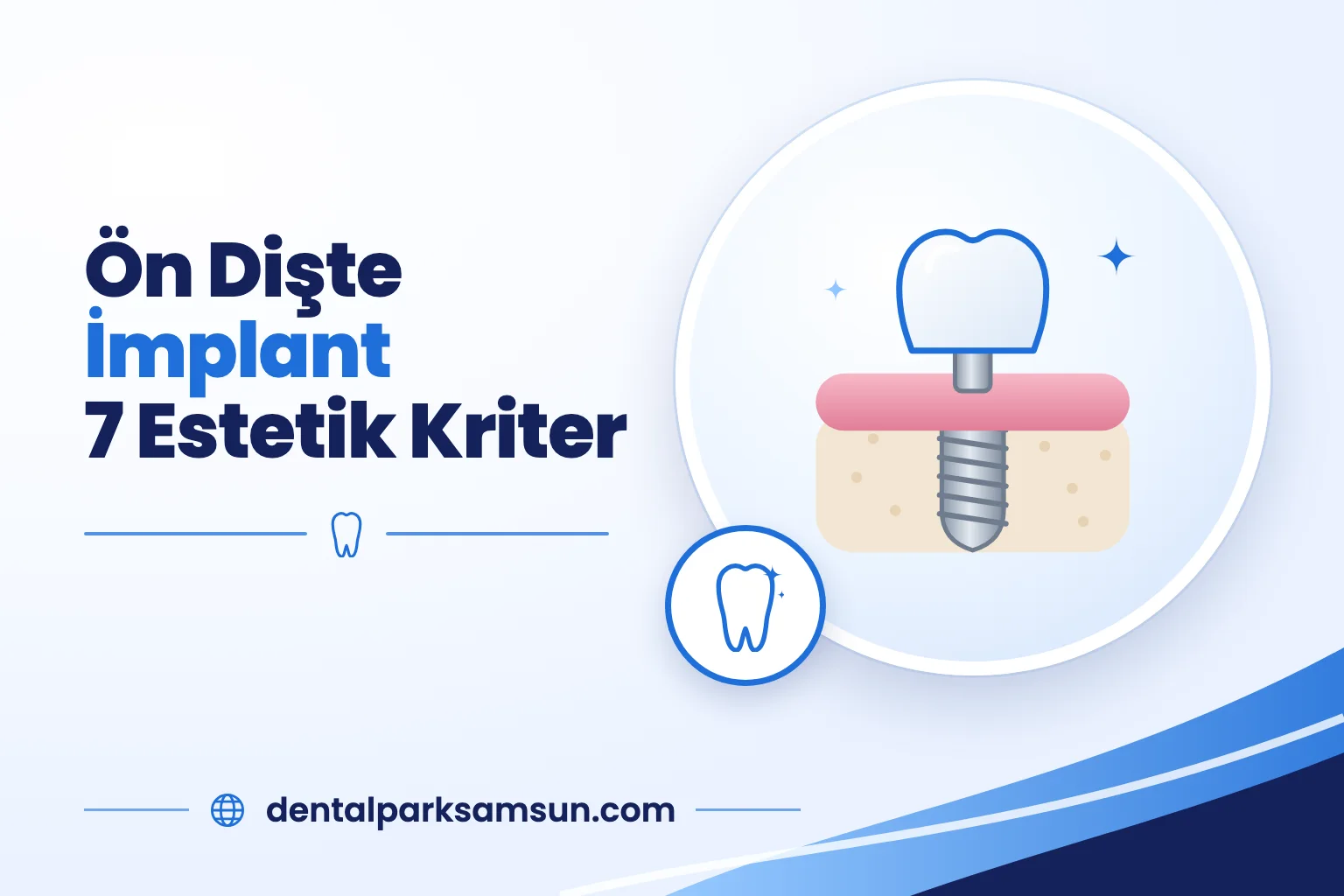 Samsun ön dişte implant için 7 estetik kriter