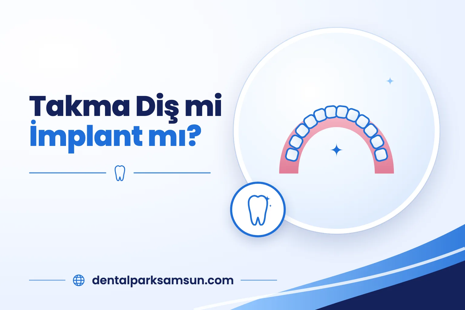 Samsun'da takma diş mi implant mı karşılaştırması