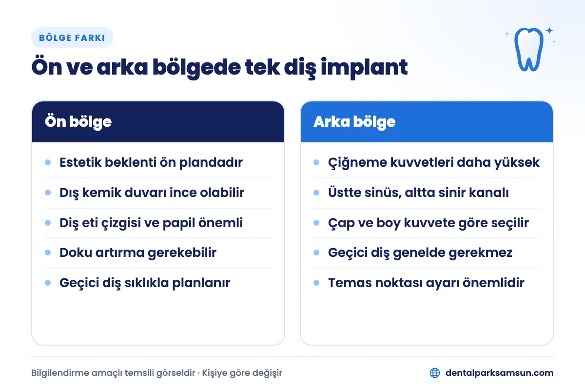 Ön bölge ve arka bölgede tek diş implant planlamasının farkları