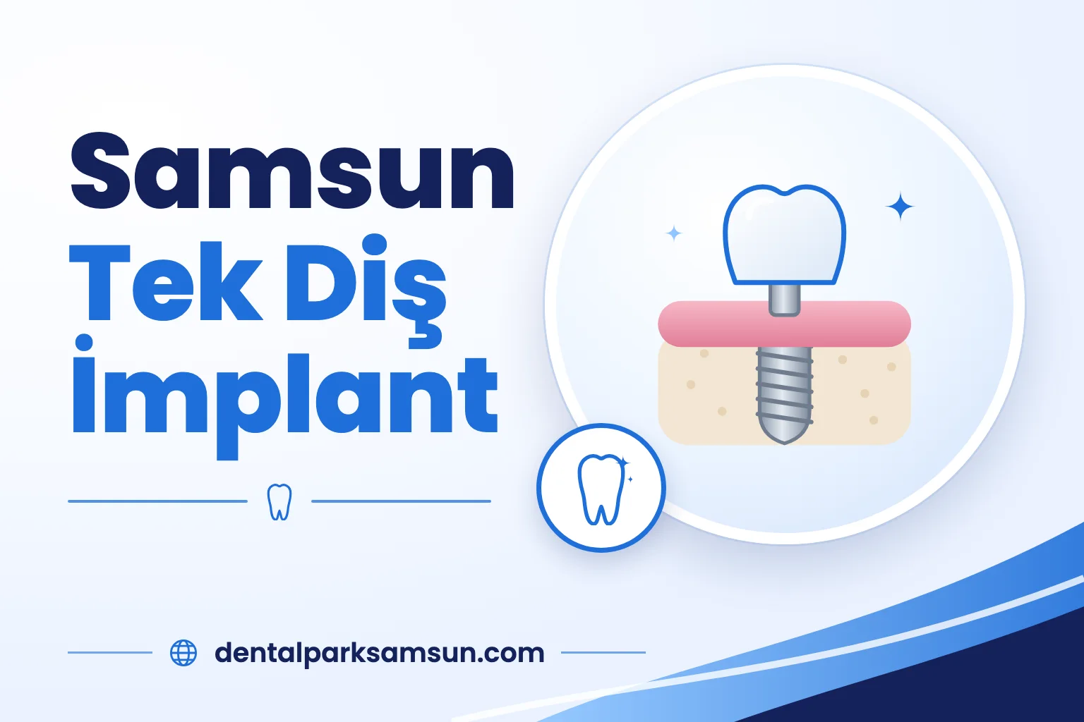 Samsun tek diş implant tedavisi